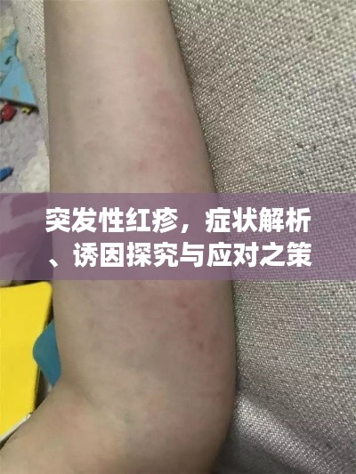 突发性红疹,症状解析、诱因探究与应对之策