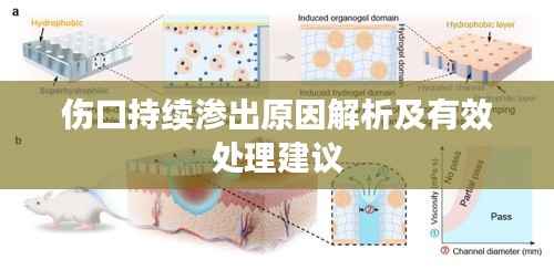 伤口持续渗出原因解析及有效处理建议